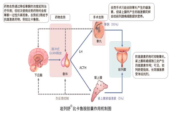 前列腺癌,不朽情缘,比卡鲁胺胶囊 前列腺癌,不朽情缘,比卡鲁胺胶囊